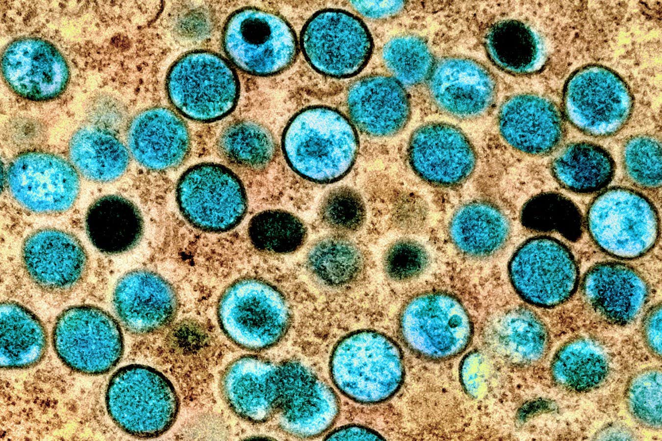 Transmission electron micrograph of mpox virus particles (teal) within an infected cell