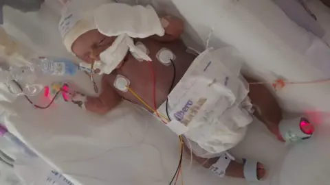 Family handout Image of Sunny wearing a knitted hat and nappy,  with tubes and various monitoring devices, in a hospital bed