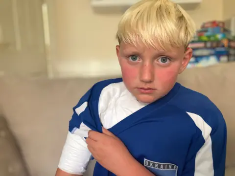 Hector, showing a bandage on his arm and wearing a blue Ukraine sport top.