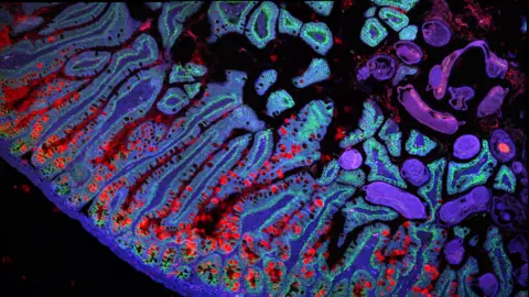 Broad Institute A kaleidoscopic image of the cells of the small intestine ranging from bright reds to deep purples. 