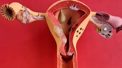 Getty Images A uterus anatomy model against red background.