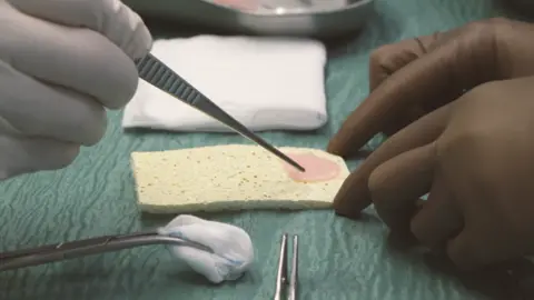 University Hospital Schleswig-Holstein A close-up image of a pink-coloured lab-grown patch of heart muscle sitting on a yellow sponge, which is being picked up by a surgeon wearing gloves and holding tweezers