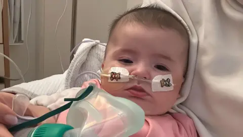 Lisa McHugh A baby in hospital with tubes coming out of her nose, she has breathing equipment in front of her. The baby is wearing a pink top.