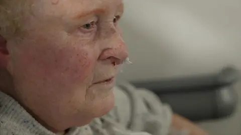 Cathleen Hill, 86, who had been waiting in a corridor for seven hours with a bloody nose