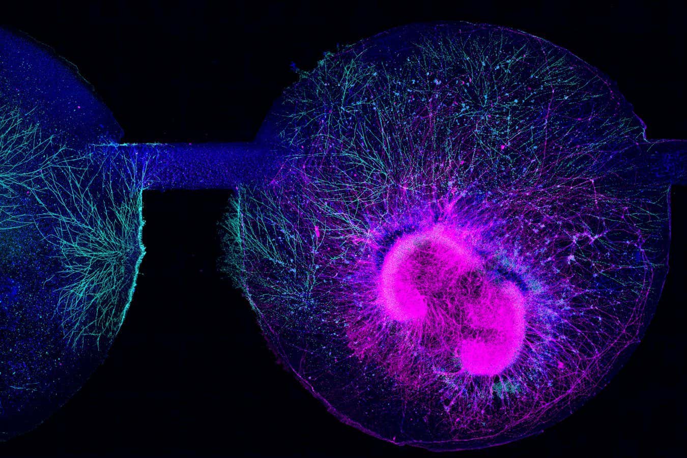 Human embryonic stem cell-derived brain organoids grown on an organ-on-chip system