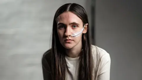 Cara sits looking at the camera against a dark, neutral backdrop. She has a nasal feeding tube running from behind her ear into her nose. She has long black hair in a middle parting and blue eyes. She wears a plain off-white jumper.