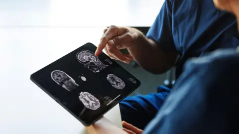 Getty Images Stock photo of two people looking at brain scans on an iPad. Only the people's shoulders and hands are in view. They are wearing dark blue surgical scrubs. One is pointing at one of the four black-and-white brain scans on the screen.