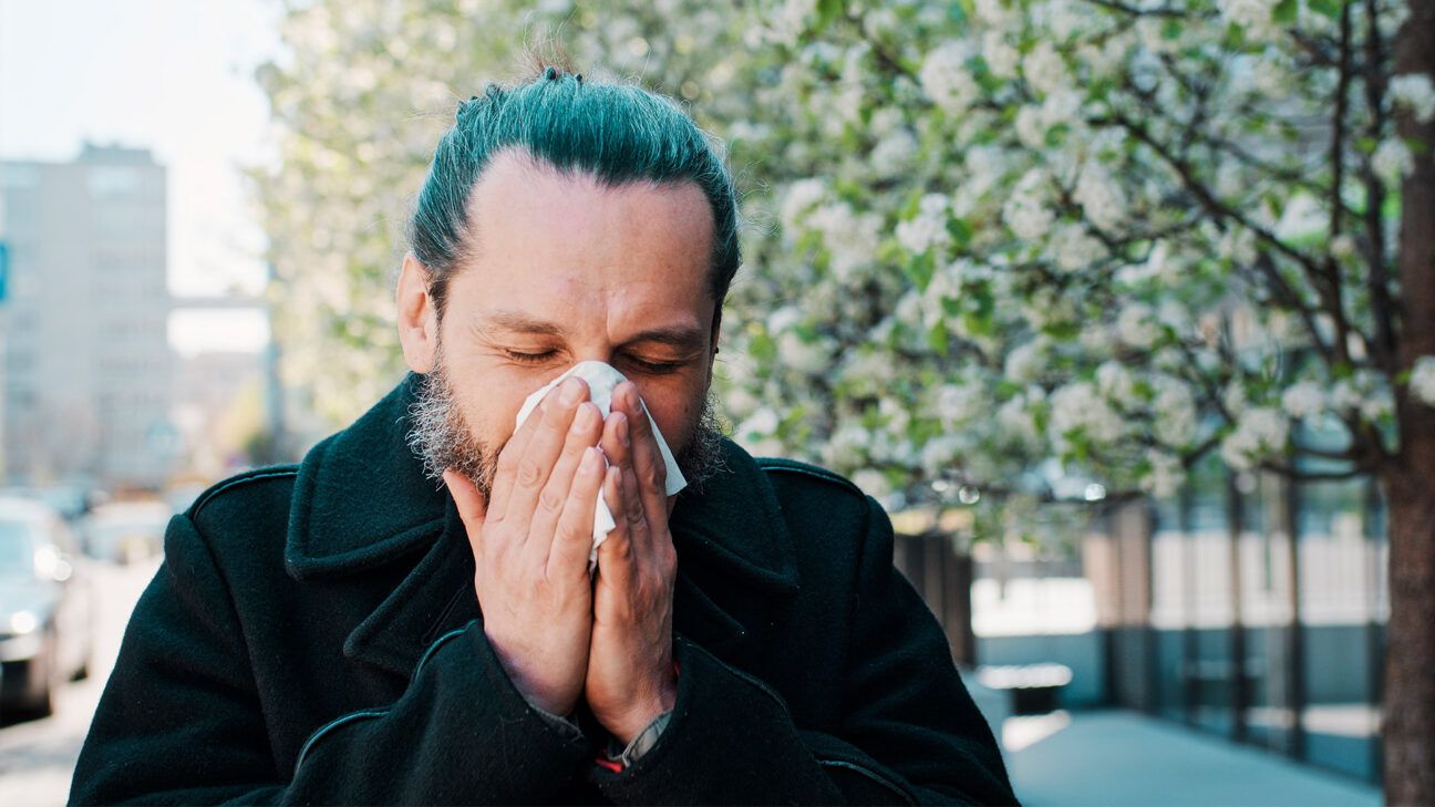 Male with blue hair experiencing seasonal allergies