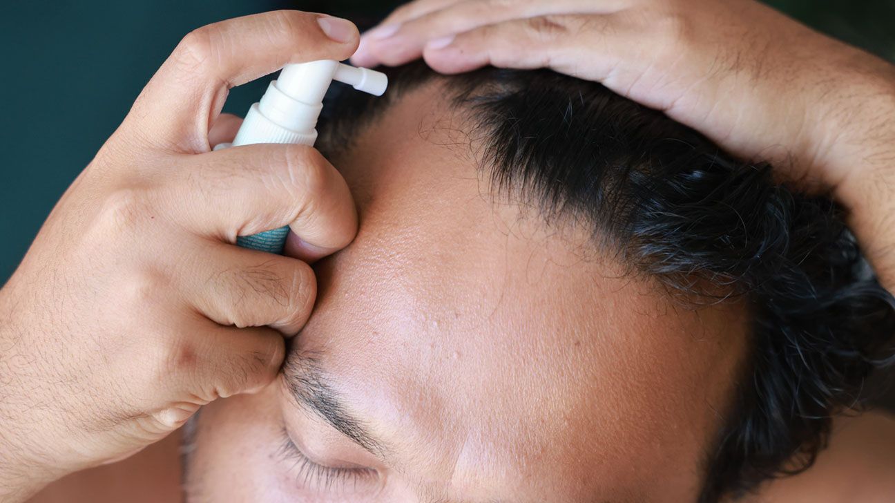 Male uses topical hair loss treatment