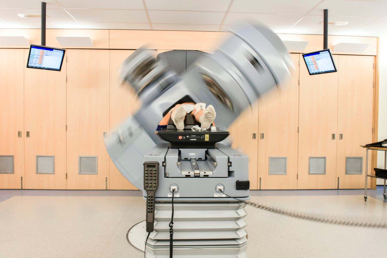 Timelapse image of a prostate cancer patient undergoing external beam radiotherapy