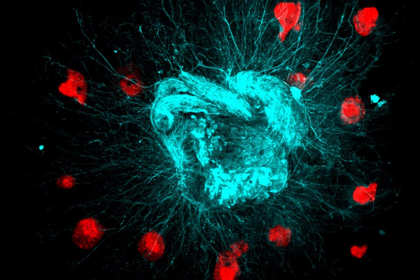 This is a pic of red mini-pancreatic tumours interacting with tendrils from many neurons (the main neuron bodies are clustered together in the middle and their tendrils are splaying out from there)