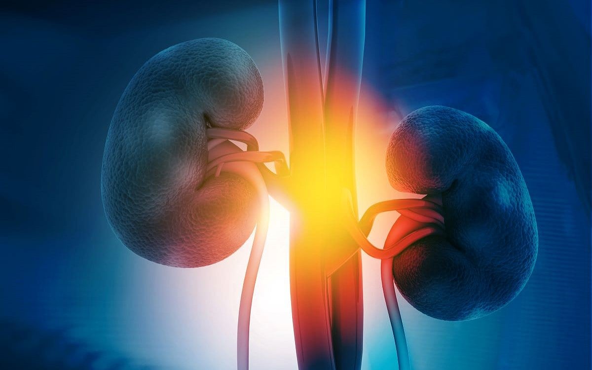 News Picture: Preemptive Kidney Transplants Add No Benefit, Study Says