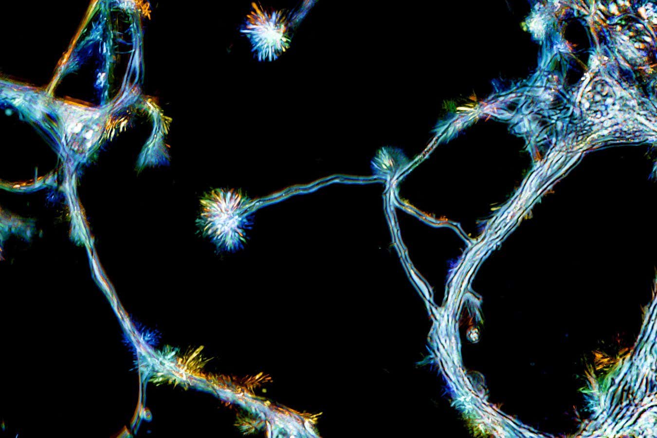 Developing brain cells from the hippocampus growing in culture