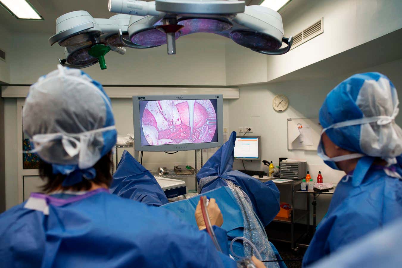 Gynecology surgery, Lenval Clinic, Nice, France Removal of an ovarian endometrium, endometriosis that forms a cyst in the ovary, by laparoscopy. (Photo by: BSIP/Universal Images Group via Getty Images)