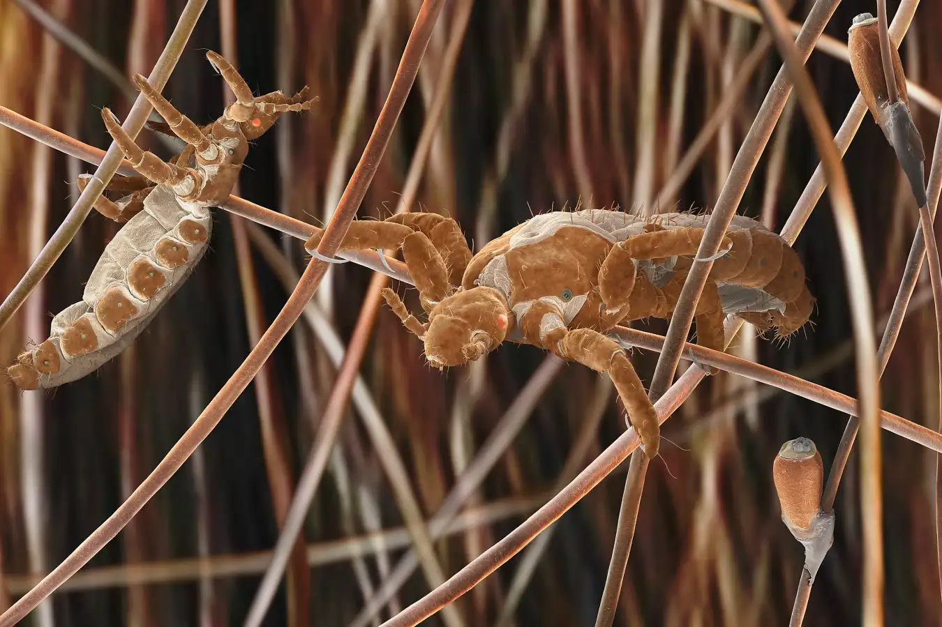 Human body lice clinging to human hairs