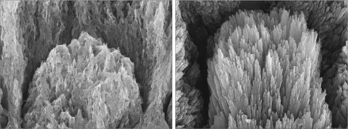 Electron microscopy images of a tooth with demineralised enamel showing eroded crystals (left) and a similar demineralised tooth after a 2-week gel treatment showing epitaxially regenerated enamel crystals (right)