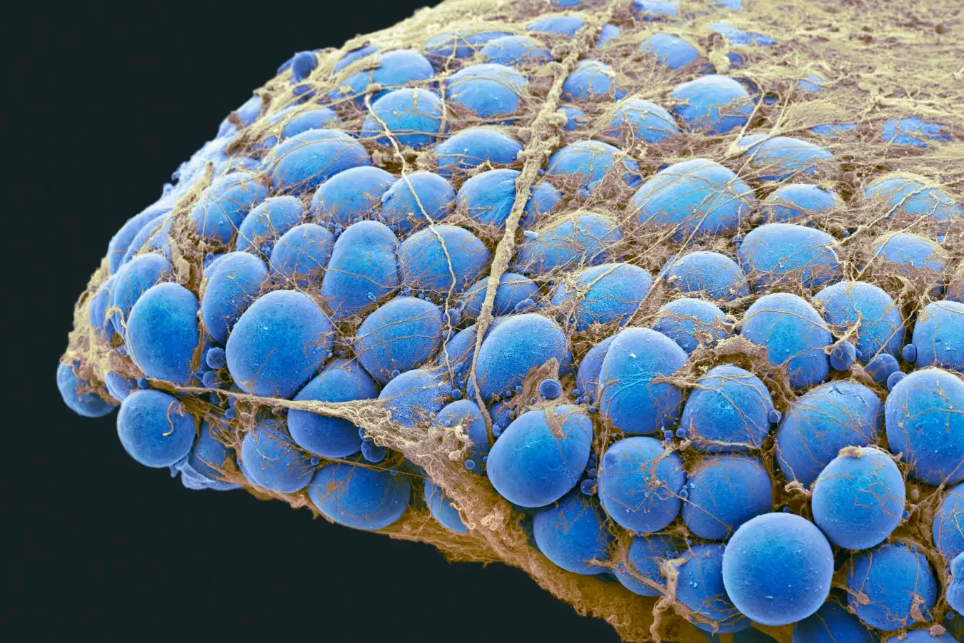 Coloured scanning electron micrograph (SEM) of a sample of fat tissue