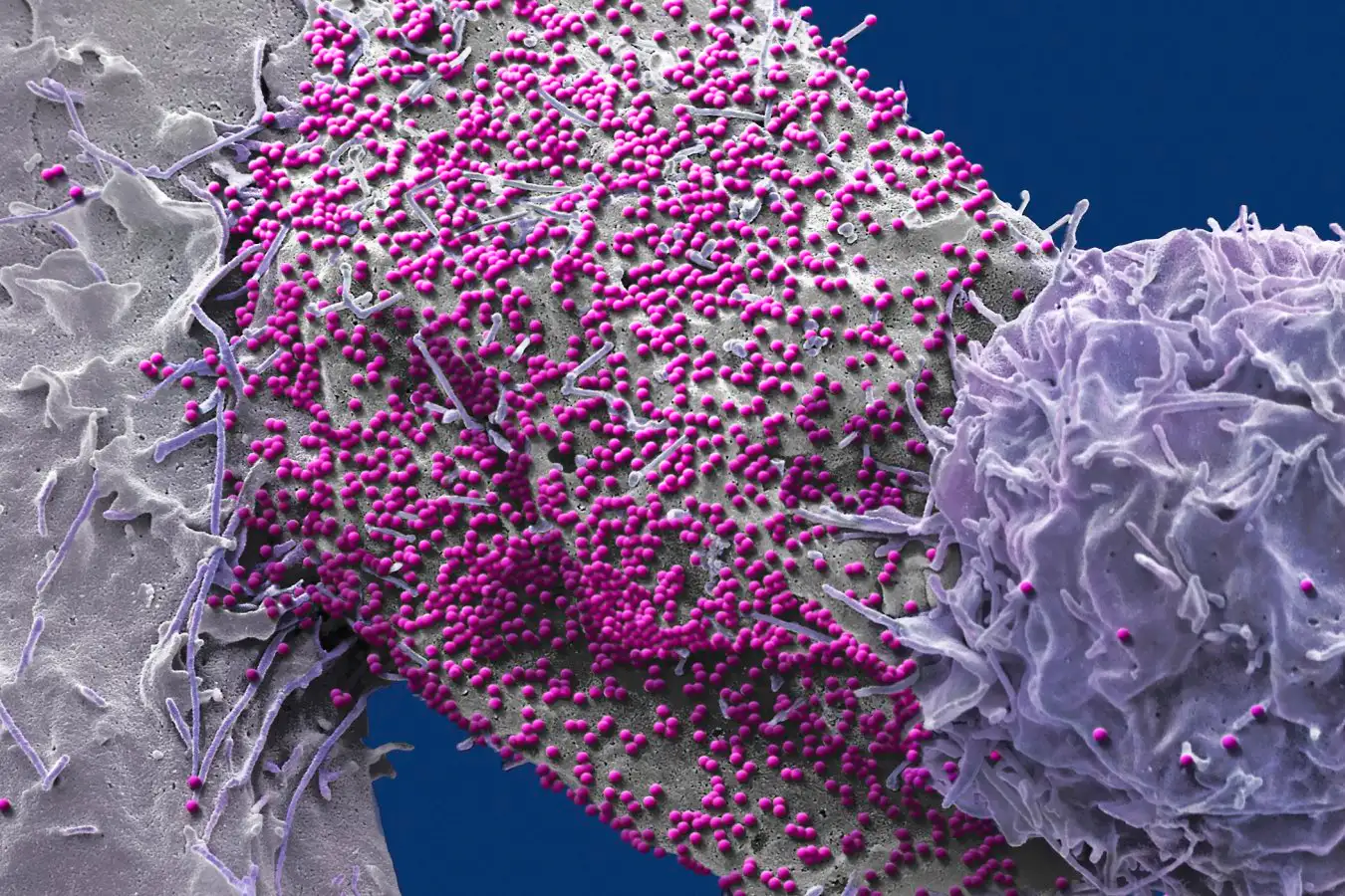 HIV infected 293T cell.