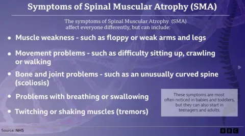 A graphic showing the symptoms of Spinal Muscular Atrophy (SMA). The background is purple and there are five bullet points in white text.
The headline reads: Symptoms of Spinal Muscular Atrophy (SMA). Under this it says: