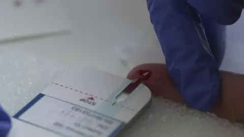 A blue gloved hand holds the finger of a male patient having a finger prick test. The blood is on the finger