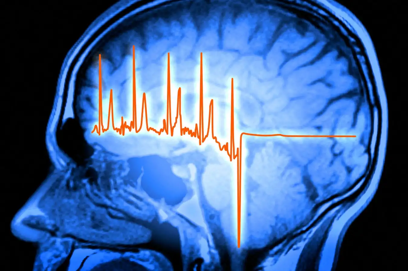 ECG trace and mri brain scan, artwork