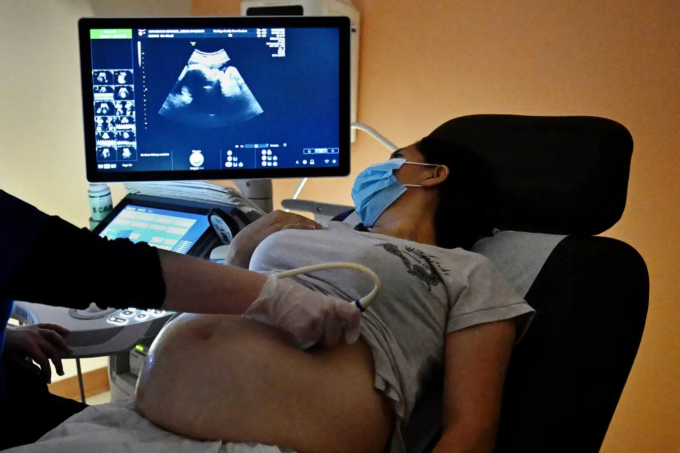 A heavily pregnant woman is laying back in a chair in a clinic. A medical professional is examining her belly with an ultrasound device, as the mother looks at her child on the screen.