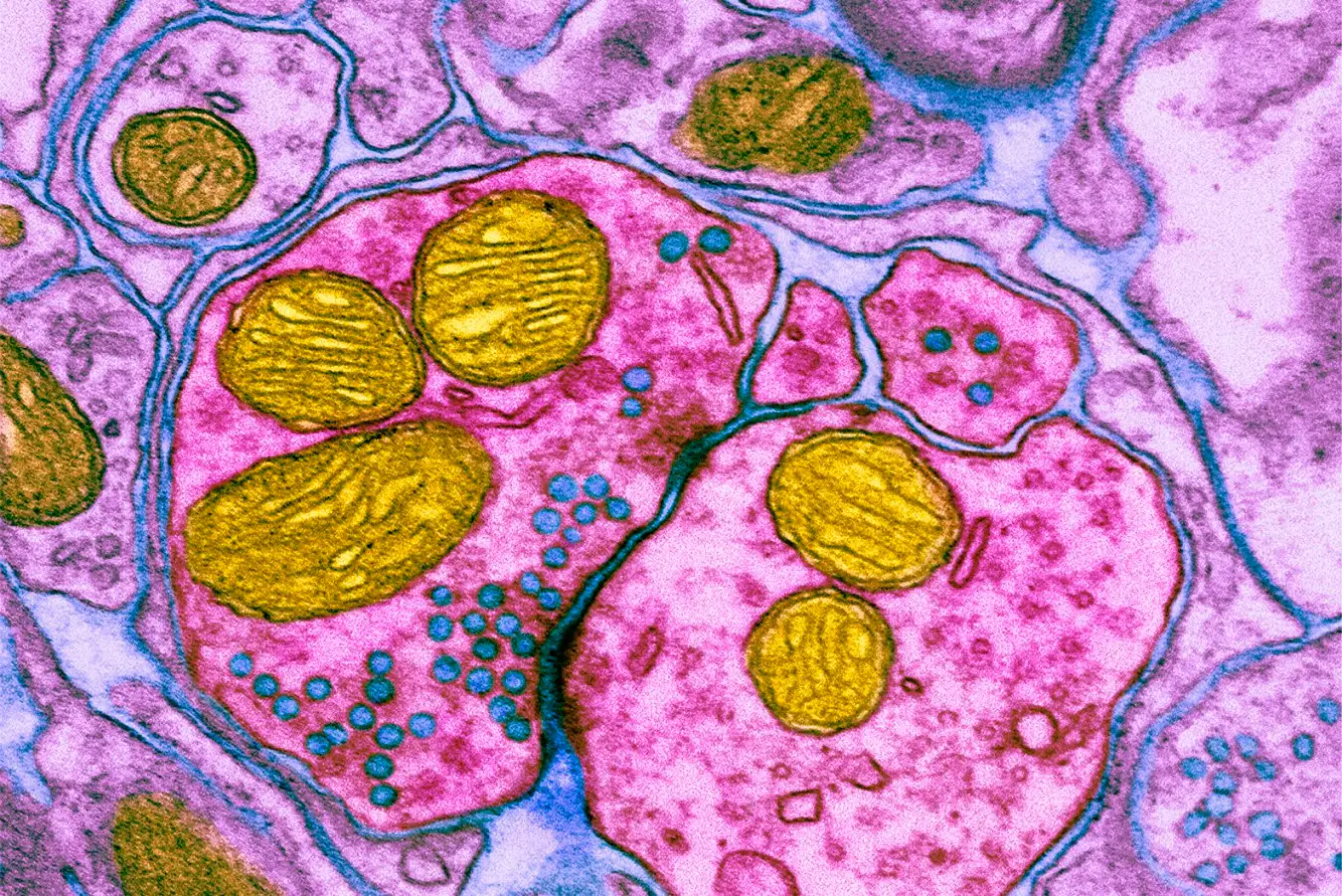 Coloured transmission electron micrograph (TEM) of a synapse, a junction between two nerve cells, in the brain. 