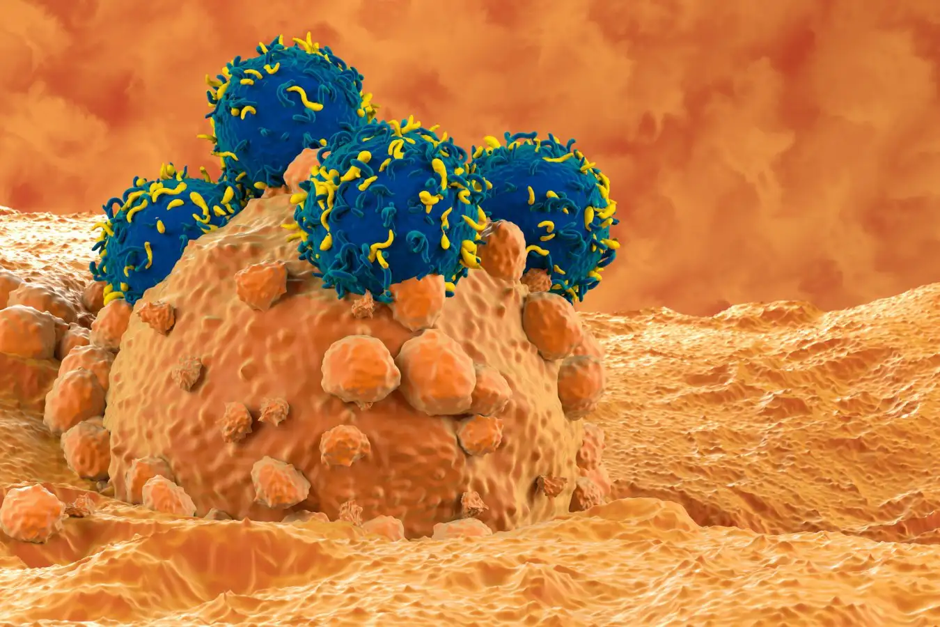 An illustration of CAR T-cell therapy in melanoma