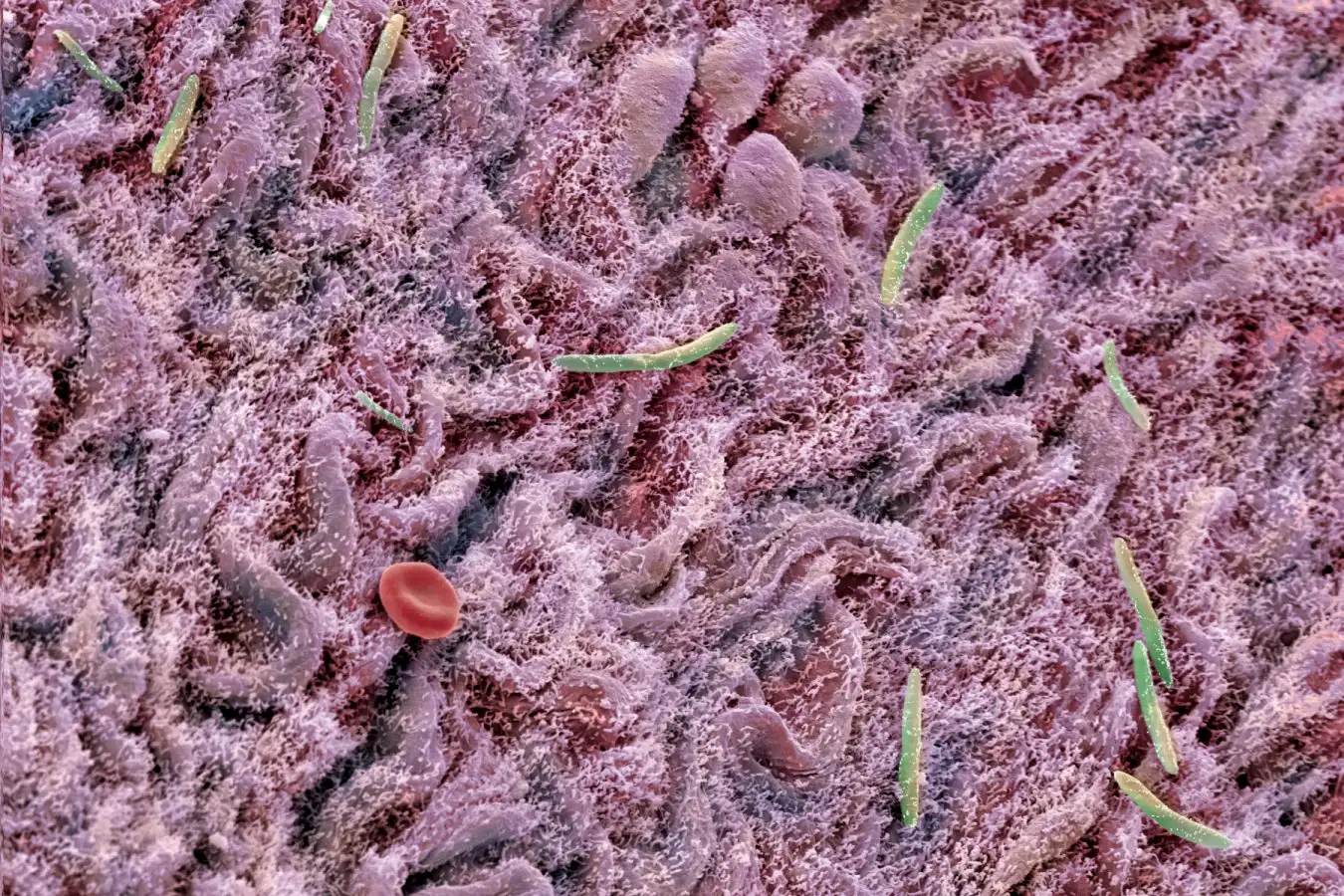 A scanning electron micrograph of the intestinal lining of a mouse, with several bacteria (green) and one red blood cell (red)