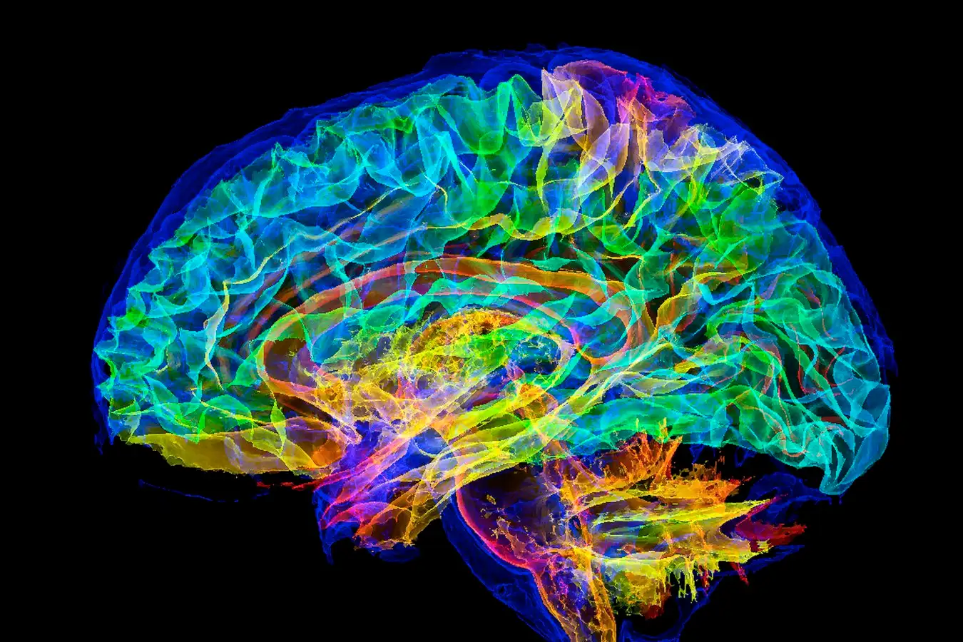 Human brain. Digitally enhanced 3D magnetic resonance imaging (MRI) scan of a normal human brain. An eyeball is shown at lower left (blue).